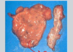 <ol><li><p>unilateral adrenal enlargement → atrophy of the contralateral side</p></li><li><p>ACTH control - conc low/undetectable</p></li><li><p>50% of adrenal glands will be calcified regardless of tumour type</p></li></ol><p></p>