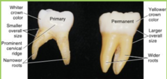 <p>Crowns are smaller and more bulbous</p><p>Greater cervical constriction</p><p>Narrow occlusal table with anatomy not well defined</p><p>Thinner enamel & dentin</p><p>Larger pulp chamber and higher pulp horns</p><p>Enamel rods in cervical area directed occlusally</p><p>Broad and flat proximal contacts</p><p>Whiter in color</p>