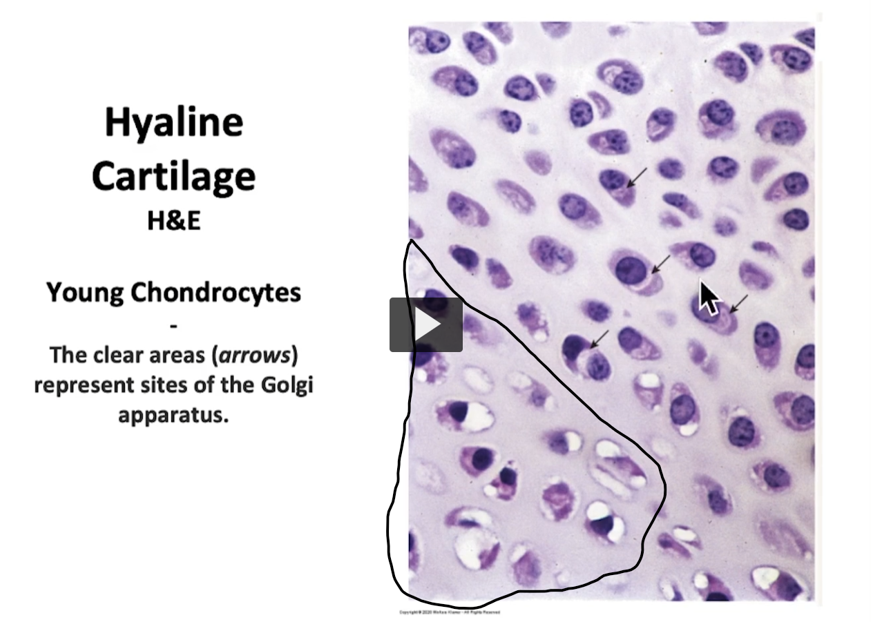 <p>Here we have an area of perichondrium, which is where we have chondroblasts differentiating into mature chondrocytes and eventually incorporating as mature cartilage tissue. </p>