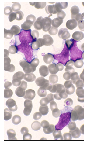 <p>Cytomegalovirus (CMV)</p>