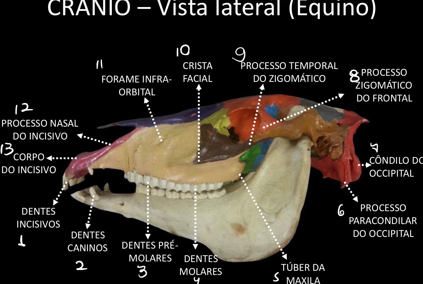 <p>Processo zigomático do frontal e processo temporal do zigomático</p>