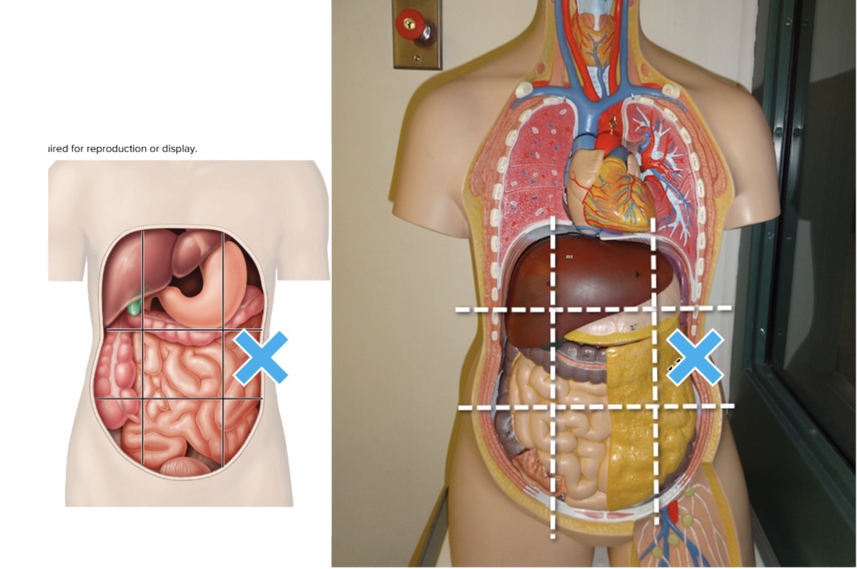 <p>Name the abdominopelvic region the mark is in</p>
