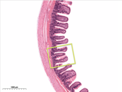 <p>the lining of the small intestine helps absorb nutrients</p>