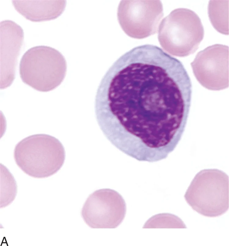<p>what is a prolymphocyte?</p>