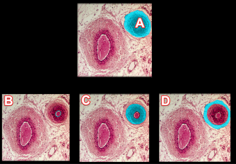 <p>In the muscular artery histology slide, <strong>Label C</strong> is the…</p>