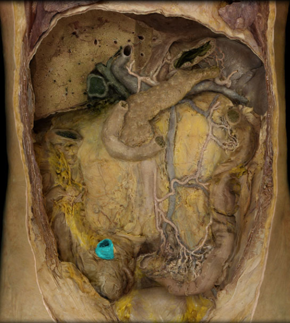 <p>Not any good pics on APR, prob look at other pic on answer side</p>