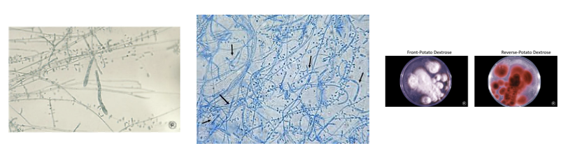 <p>ID this mold </p>
