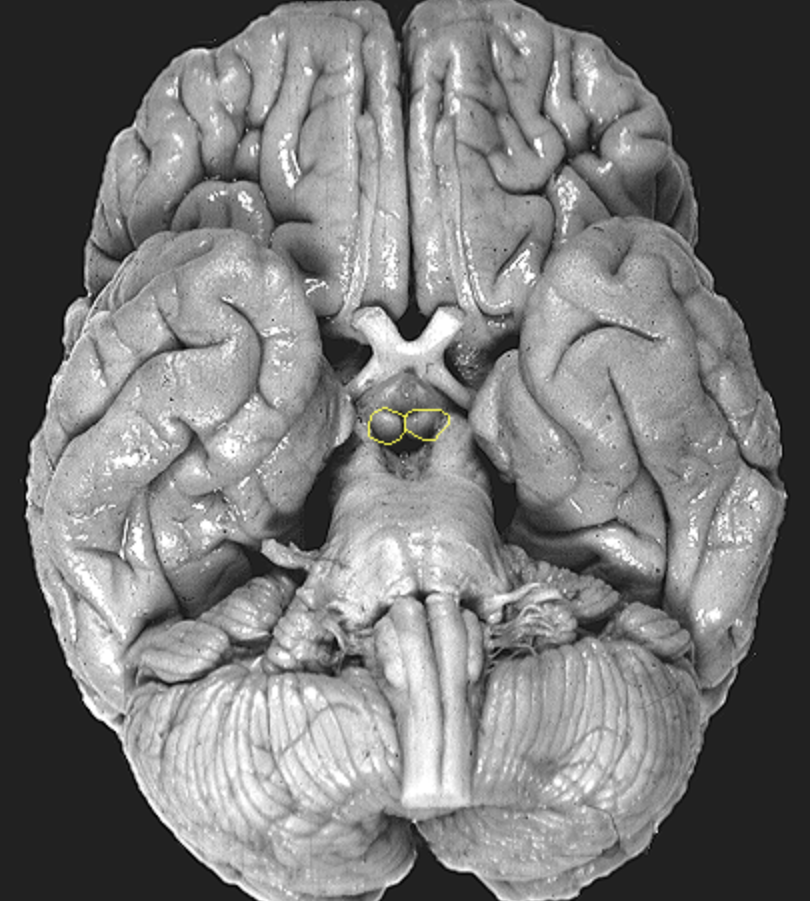 <p>What is the area highlighted called?</p>