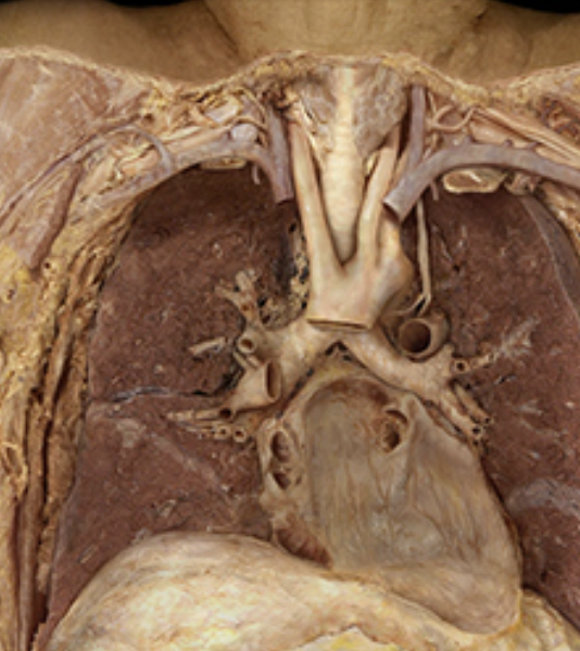 <p>Identify the trachea</p>