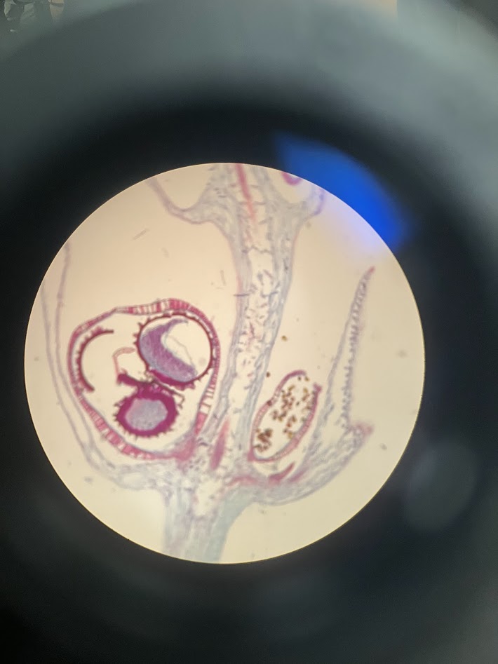 <ol><li><p>what is the phylum?</p></li><li><p>what is the structure on the left?</p></li><li><p>what is the structure on the right?</p></li><li><p>what is the ploidy of the structure on the left?</p></li><li><p>what is the ploidy of the structure on the right?</p></li></ol><p></p>