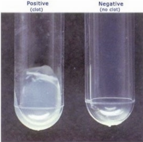 <p>differentiates Staphylococcus aureus (positive) from less pathogenic coagulase-negative staphylococci (CONS) by detecting the enzyme coagulase, which clots plasma. incubate at 35C </p>