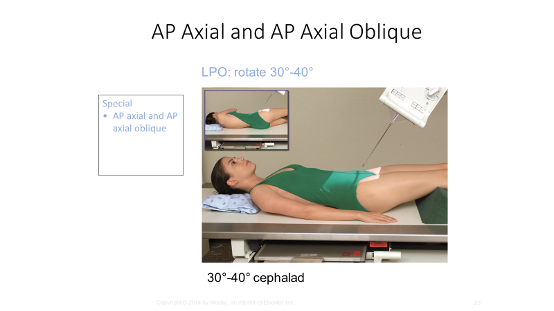 <p>14×17, CR 2 below ASIS, (LPO) 2 from MSP to upside</p>
