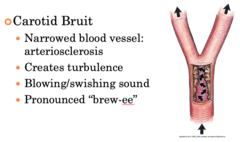 <p>B. bruit</p>