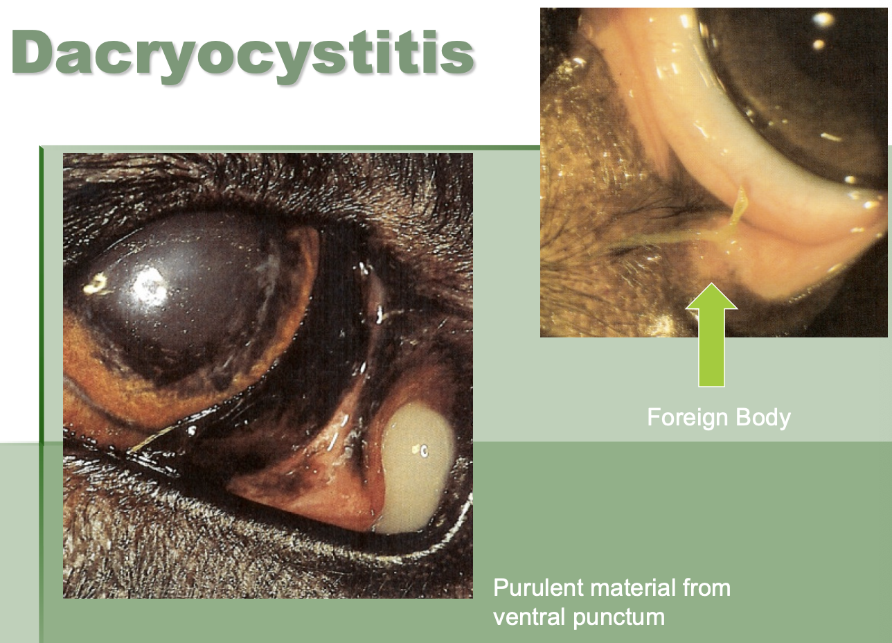 <p>Dacryocystitis CS (4)</p>
