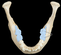 <p>Back teeth (3 total) </p><p>**no baby predecessors</p>