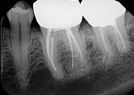 <p>Radiopaque Film Images</p>