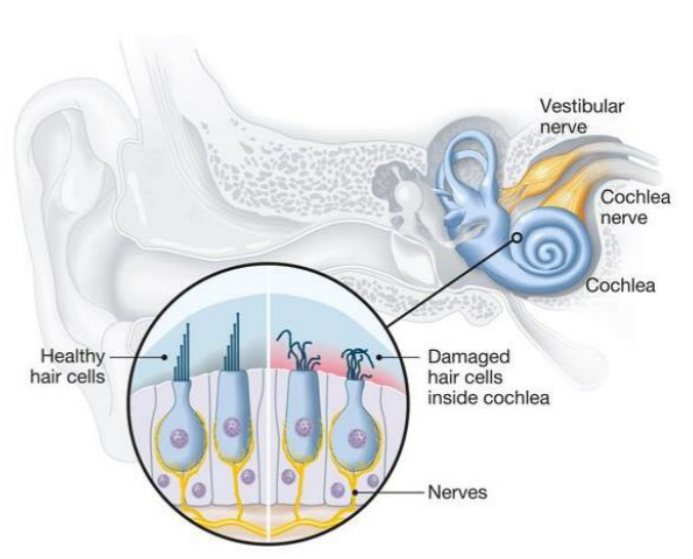 <p></p><ul><li><p>Sensory receptors cells for hearing</p></li><li><p>Mechanoreceptors - increases/decreases in air pressure</p></li><li><p>In organ of corti in cochlea </p></li></ul><p></p>