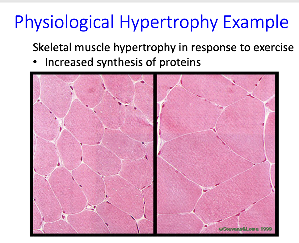 <p>skeletal muscle hypertrophy in response to exercise</p><ul><li><p>increased synthesis of proteins → size and volume of individual fibers increase</p></li><li><p>number of fibers <strong>does not</strong> increase</p></li></ul><p></p>