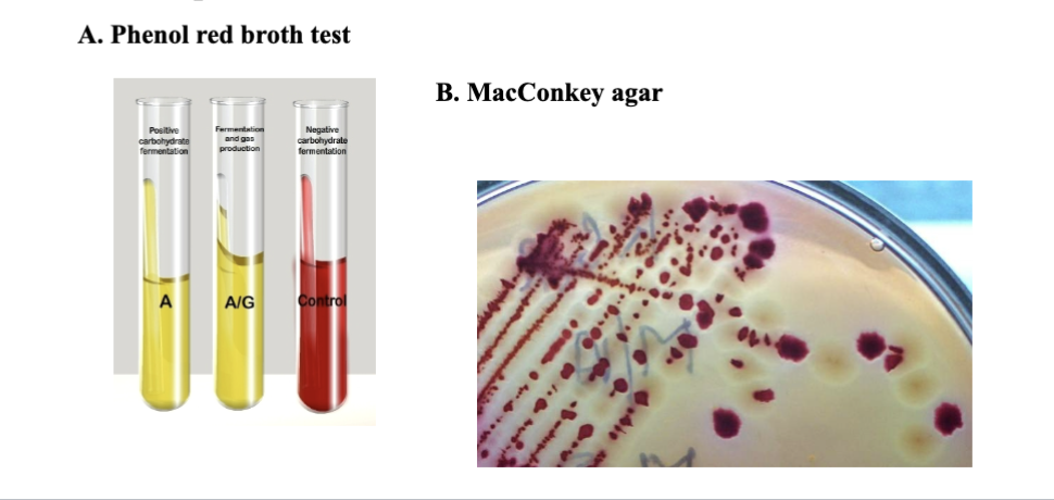 <p>to quickly identify the microbe causing the disease and prescribe an effective antibiotic, hospitals use rapid and inexpensive biochemical tests, like the phenol red broth test and MacConkey agar. Researchers use fermentation as a tool to create a metabolic fingerprint based on what an organism can and can’t ferment. </p>