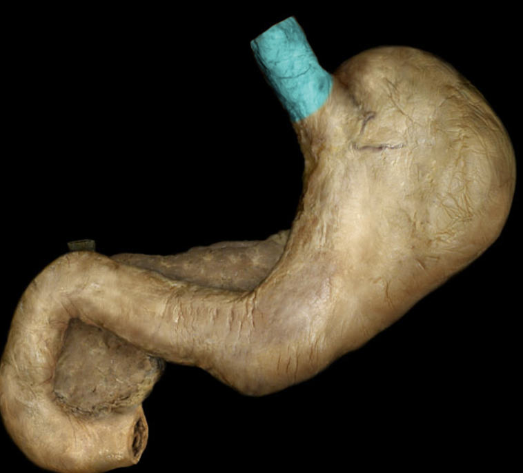 term image