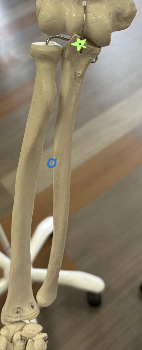 <p>Green star: What is this structure?</p><p>Blue circle: What is this structure?</p><p>What muscle inserts on the green star structure and what happens if its injured?</p>