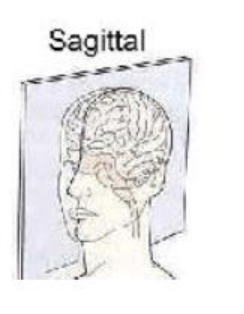 <p>Slides from side to other side</p>