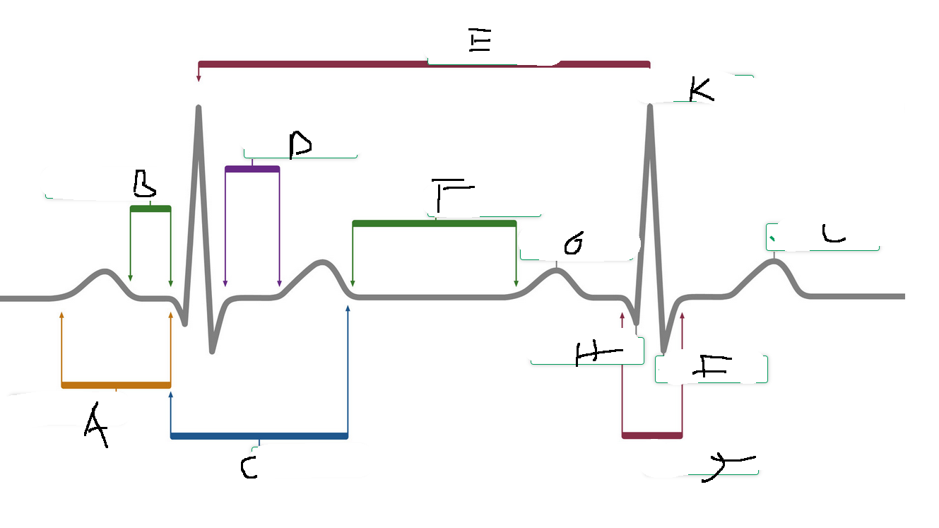 <p>According to the ECG diagram, what label marks the PR interval?</p>