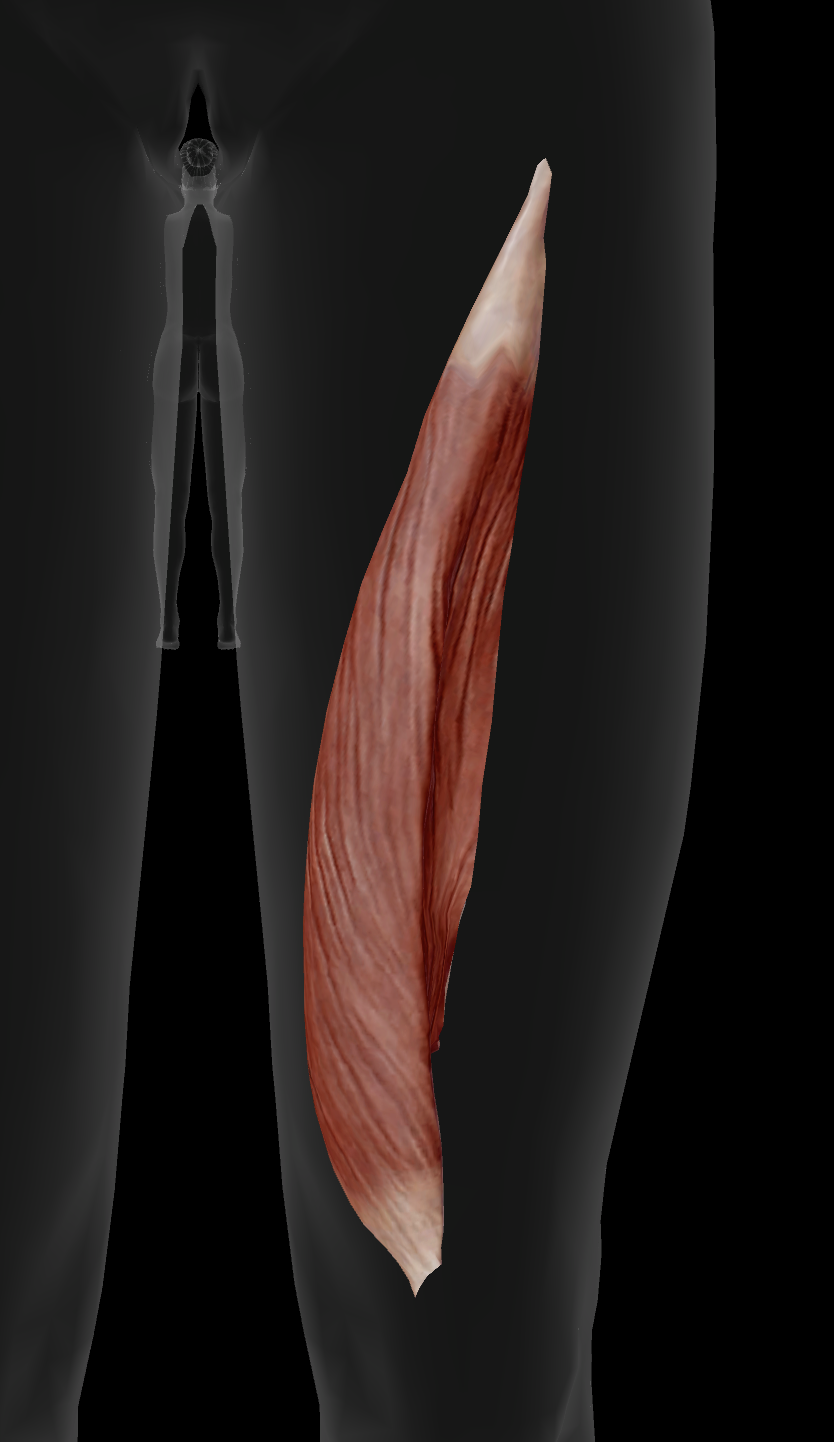 <p>Vastus Medialis Origin</p>