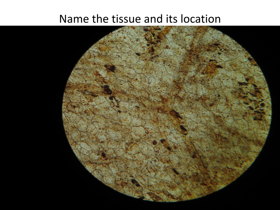 <p>Name of this tissue?</p>