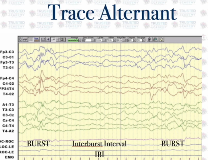 <p>Trace alternant</p>