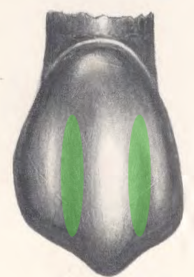 <p>Developmental depressions are typically exhibited as _______</p>