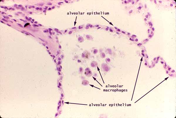 <p>found in Respiratory bronchioles</p>