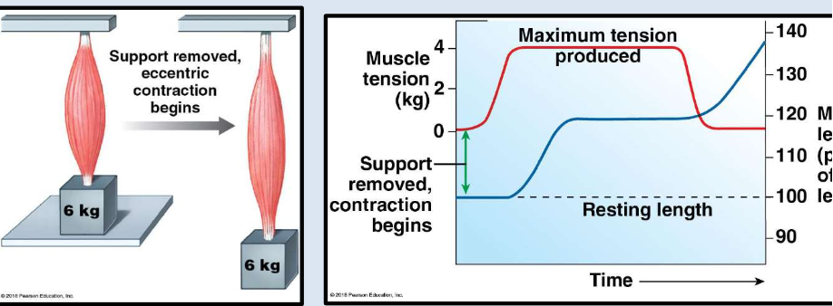<p>In a <strong>concentric</strong> contraction, the muscle tension <strong>exceeds</strong> the load, and the muscle <strong>shortens</strong>. Bicep curl going <strong>up</strong>.</p>