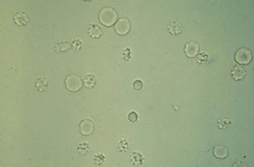 <p>What is this RBC shape?</p>