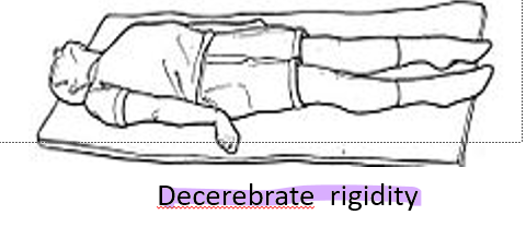 <p>Decerebrate</p>