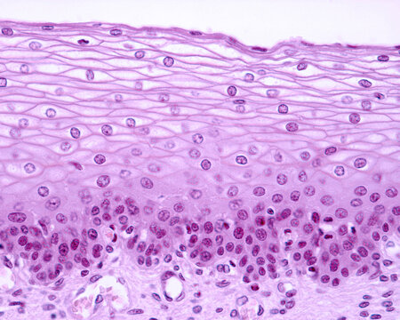 <p>Where is Nonkeratinized Stratified Squamous found?</p>