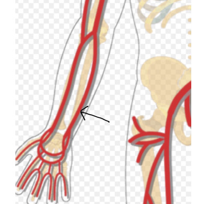 term image