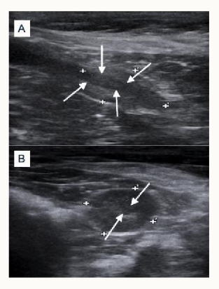 <p>Describe and compare these two dog prostate ultrasounds</p>