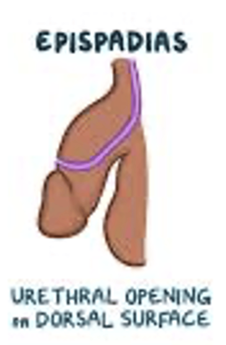 <p>urethra opens onto the dorsal penile surface</p>