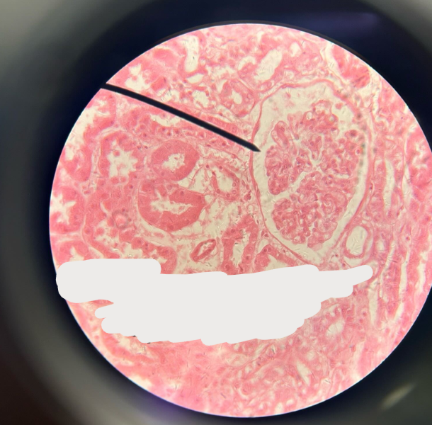 <p>ID tissue</p>