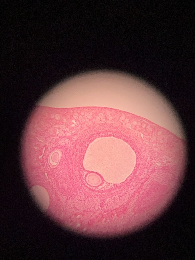 <p>This slide depicts which endocrine gland</p>