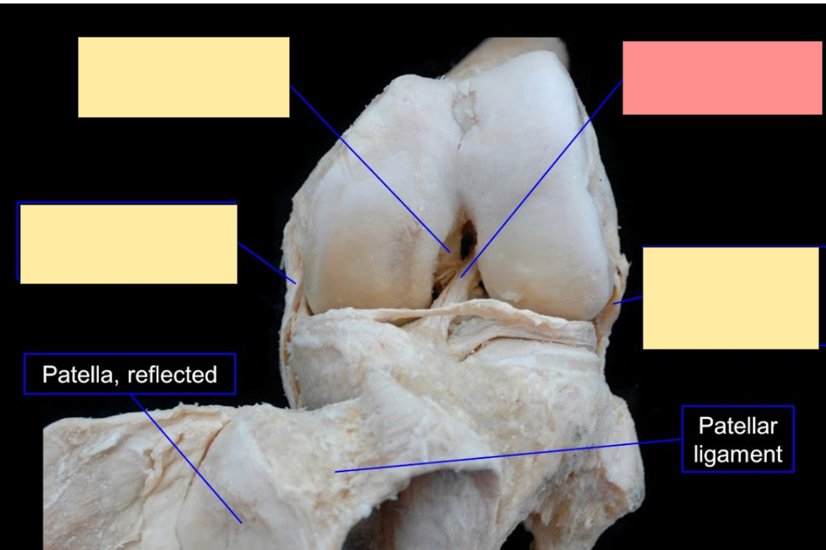 <p>Identify the structure</p>