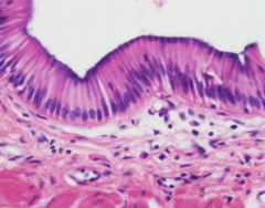 <p>-stomach, colon</p><p>-outermost cell type</p>