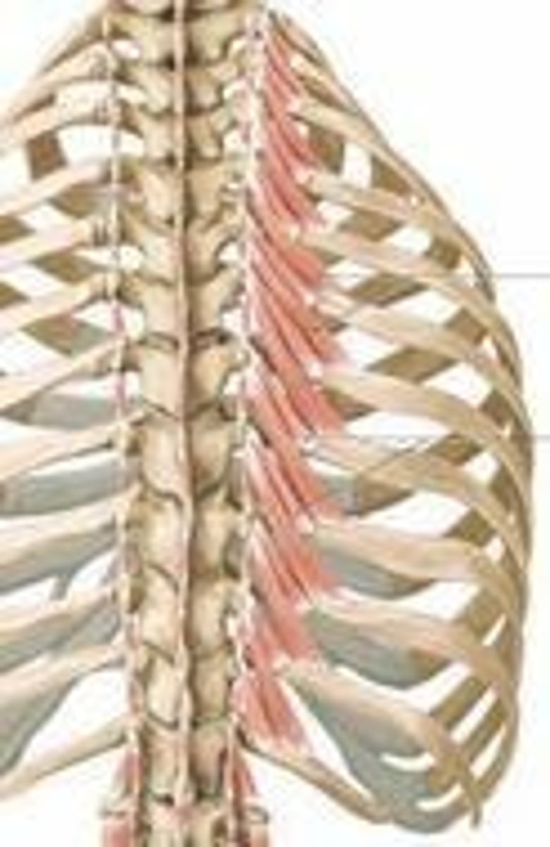 <p>rib below vertebrae of origin</p>