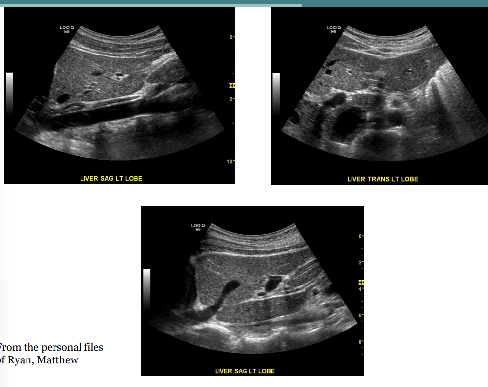 <ul><li><p>It has medial and lateral lobes.</p></li><li><p>It is divided into segments by the left hepatic vein.</p></li><li><p>It contains the left portal vein and left hepatic artery.</p></li><li><p>It is imaged using the subxiphoid window.</p></li></ul><p></p>