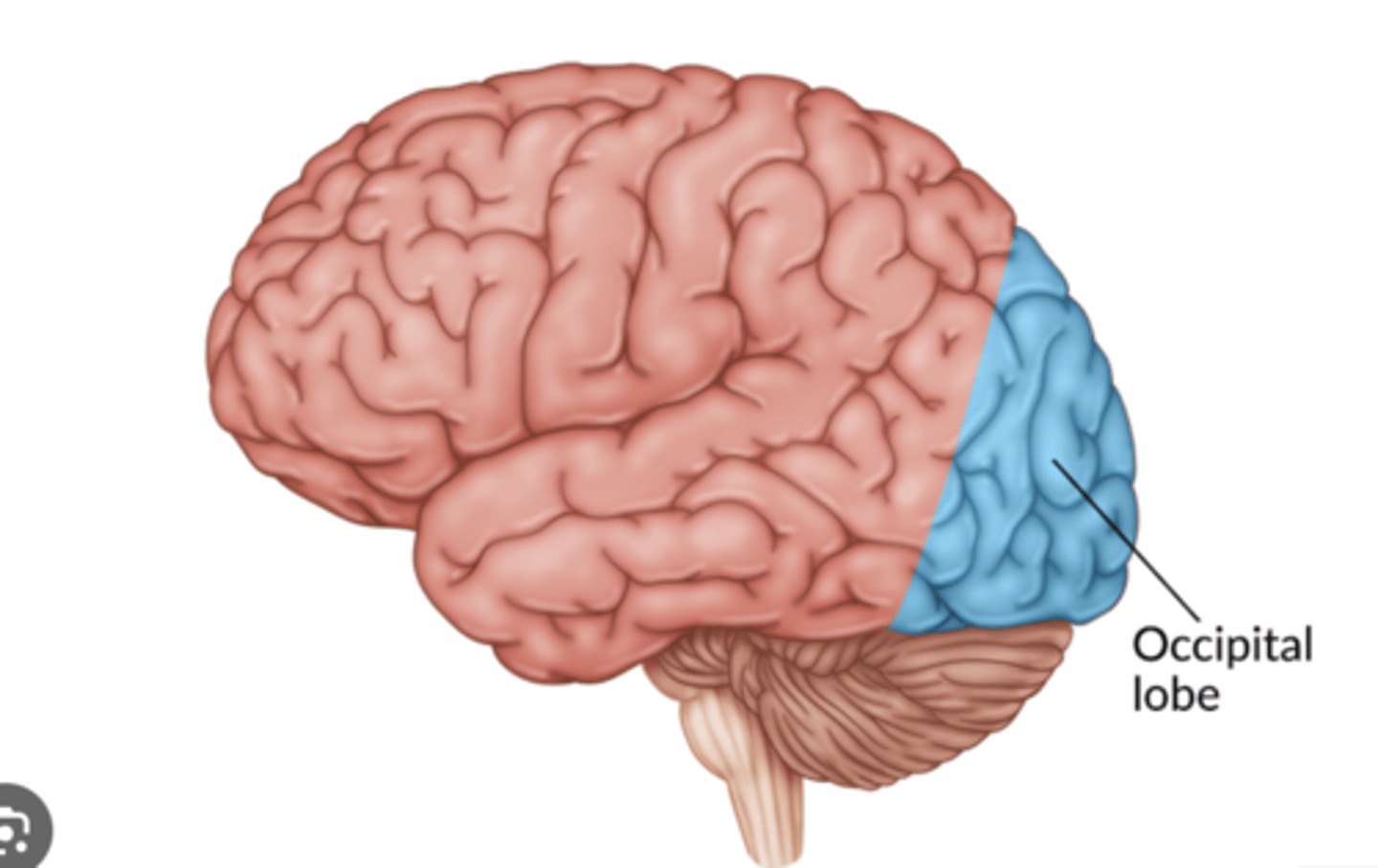 <p>contains the visual cortex. Damage to the occipital lobe can result in visual agnosia (inability to recognize familiar objects), color agnosia, word blindness, and/or scotomas (blind spots). Lesions at the junction of the occipital, temporal, &amp; parietal lobes can produce prosopagnosia (inability to recognize familiar faces).</p><p>- back: high-res macular</p><p>- front: peripheral</p><p>damage?</p><p>- visual agnosia, visual hallucinations, cortical blindness</p>