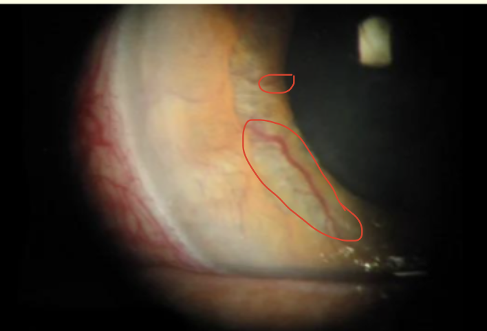<p>describe + diagnose </p>