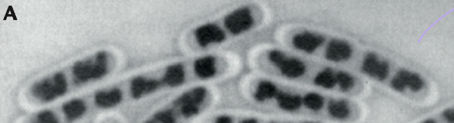 <p>What is being stained in this cell?</p>