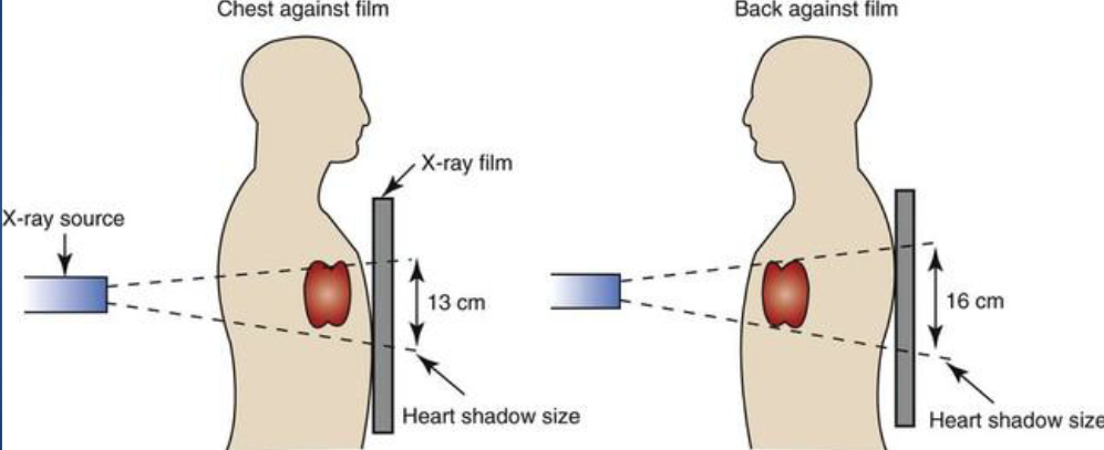 <p>xray source is closer to the organ than xray film</p><p>*OID (object to image receptor distance)</p><p></p>