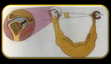 <p>-directly horizontally toward the midline</p><p>-the medial pole of the condyle prevents any side shift until after the condyle has moved downward along the eminentia</p>